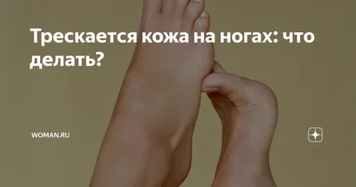 Трескается кожа на ногах: что делать? | Женский журнал Клео | Дзен