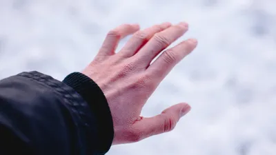 Синяя кожа и покалывание: как омичу распознать опасное обморожение? —  Новости о красоте и здоровье Омска