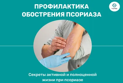 Псориаз: эффективное лечение в домашних условиях — Allergika (Аллергика)  Украина