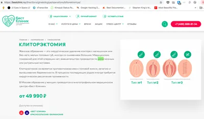 Плюсы и минусы обрезания - показания к проведению циркумцизии