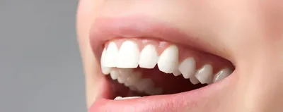 Несъемное протезирование зубов в клинике Dental Brothers