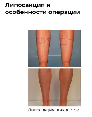 Толстые щиколотки как кошмар в моей жизни - ответы с 30 по 60 - Советчица