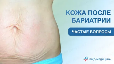 Обвисшая кожа – как избавиться и предотвратить ! Как подтянуть кожу после  похудения - YouTube