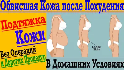 Почему у меня обвисла кожа, и что я могу с этим сделать?