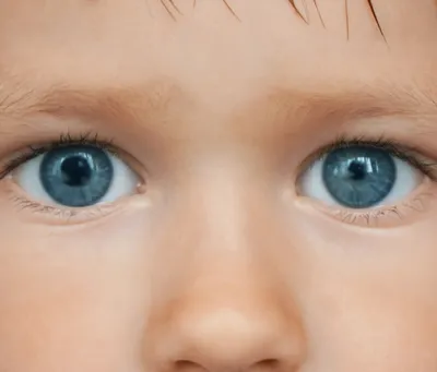 Проблема с глазиком у ребёнка 3 месяца — 15 ответов | форум Babyblog