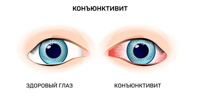 Ответы Mail.ru: Одно веко меньше другого, да и вообще глаза стрёмные