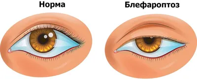 Советы остеопата: откуда берется асимметрия лица и можно ли исправить ее  без операции | MARIECLAIRE