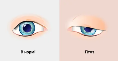 От чего зависит цвет глаз у человека: таблица зависимости. Как наследуется  цвет глаз. Как передается доминантный цвет глаз