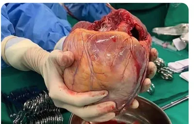 Большое сердце, сделанное бумажных сердец, изложенных в белый фон. Стоковое  Фото - изображение насчитывающей лепесток, вкусно: 207673158
