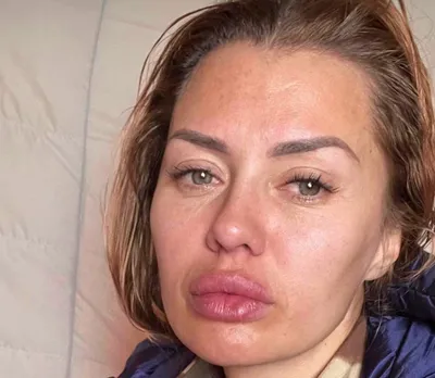 Бузова показала свое лицо полностью без макияжа после косметолога - YouTube