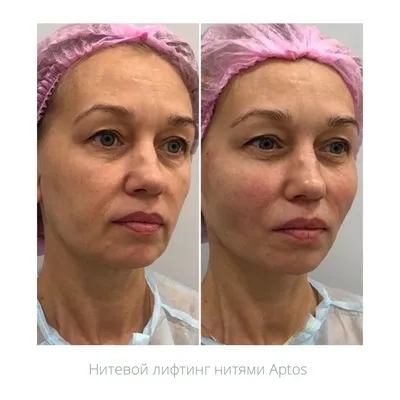 Омолаживающий макияж фото до и после фото