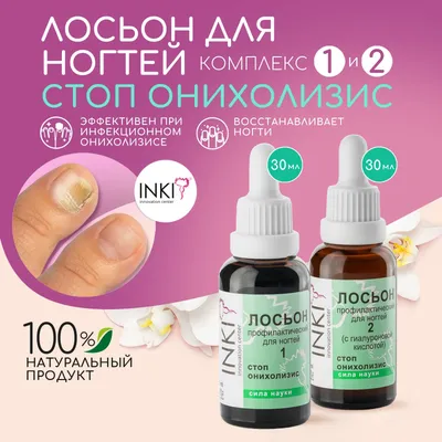 Nails.lashes_Apsheronsk - Онихолизис - что это? Надо ли паниковать?🤔 ...  Онихолизис (onycholysis) - полное или частичное отделение ногтевой  пластинки от ногтевого ложа. Отделение ногтя от ногтевого ложа чаще всего  происходит со свободного