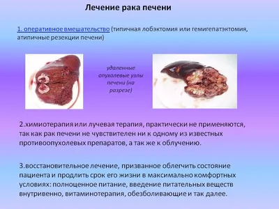 Меланома кожи: симптомы, классификация, стадии, прогноз, диагностика и  методы лечения меланомы кожи