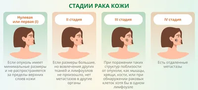 Рак кожи: симптомы, как выглядит, признаки, стадии, лечение