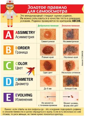 Меланома: как распознать опасные родинки? | Диагноз - YouTube
