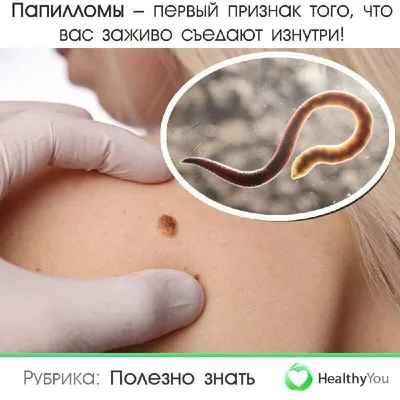 Подкожные черви-паразиты атаковали купающихся в озере Автозаводского района