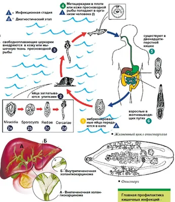 Описторхоз фото на коже фото