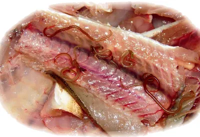 Описторхоз в рыбе фото фото