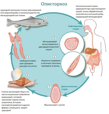 Описторхоз - БУ \"Нижневартовская городская поликлиника\"