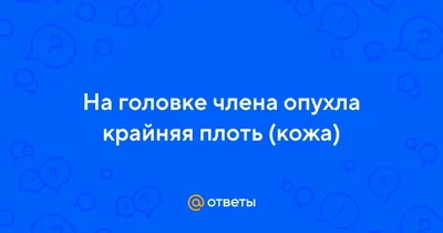 Баланопостит может причинять дискомфорт и иногда боль | Институт Мужского  Здоровья (Томск) :: Клиника для Мужчин