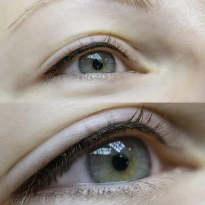 Лесси - Ветеринарная Клиника - Киев - Когда помочь уже невозможно.  Метастатическая опухоль глаза. Наиболее частыми первичными опухолями, при  которых возникают метастазы в орган зрения, является рак молочной железы.  По статистике, примерно