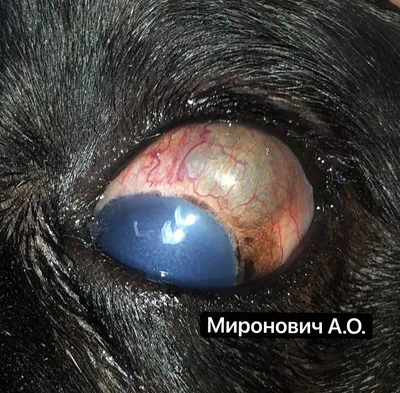 Пензенский центр микрохирургии глаза - Глазное веко – довольно тонкая  кожная складка, защищающая глаз от различных повреждений и отвечающая за  очищение склеры и роговицы. ⠀ Даже небольшая опухоль может доставлять  человеку немало