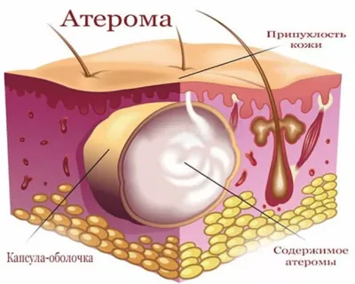 Онкодерматология » Клиника косметологии и дерматологии «ACADEMY» — лечение  кожи и волос.