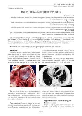 Опухоли сердца. Клинические наблюдения – тема научной статьи по клинической  медицине читайте бесплатно текст научно-исследовательской работы в  электронной библиотеке КиберЛенинка