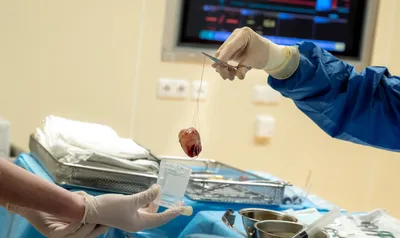 В Петербурге врачи остановили новорождённому сердце, чтобы удалить опухоль