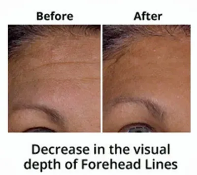 Best 100% Under Eye Cream - Remove Dark Circles Wrinkles Face Lines Puffy  Eyes | eBay