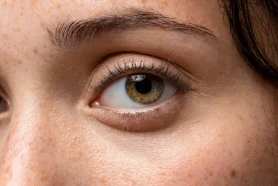 Best 100% Under Eye Cream - Remove Dark Circles Wrinkles Face Lines Puffy  Eyes | eBay