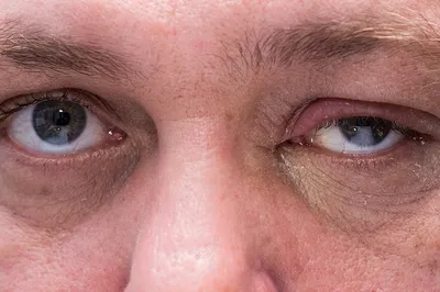 Опухшие глаза и несвежий вид: Григорий Лепс без очков сам на себя не похож  (фото)