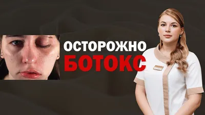 Ботокс (Botox) - Все что необходимо знать про Ботулотоксин - ЦИДК