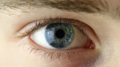 Серьезный сигнал»: о каких болезнях говорит изменение цвета глаз