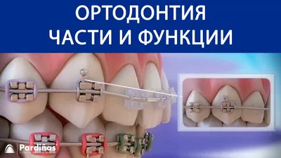 Ортодонтия. Работаю быстро и качественно. (91305) - Зуботехнические  лаборатории - NaviStom.com