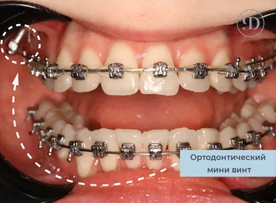 Стоматология «ОртодонтиЯ» на 40-летия Победы - 9 врачей, 26 отзывов |  Краснодар - ПроДокторов