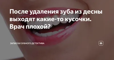 После удаления зуба из десны выходят какие-то кусочки. Врач плохой? |  записки зубного детектива | Дзен