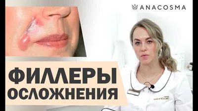 Etermis омоложение кожи лица филлером в Калининграде