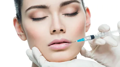 Увеличение губ: последствия и осложнения, как избежать при применении  гиалуроновой кислоты - Клиника красоты Bellezza Киев