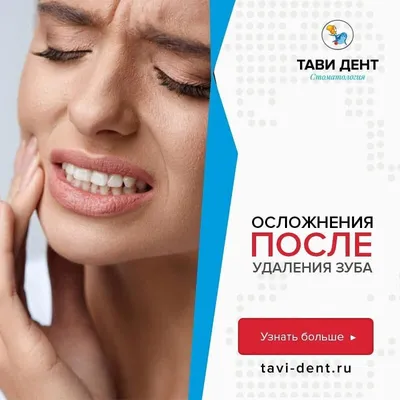 Осложнения после удаления зуба | КАЛЕЙДОСКОП TAVI-DENT.RU | Дзен
