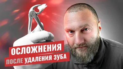 Какие могут возникнуть осложнения после удаления зуба?