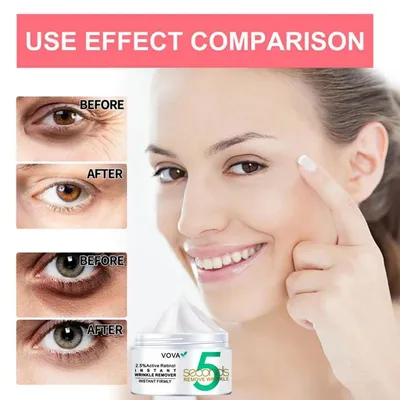 Skin Doctors Крем для уменьшения мешков и отечности под глазами \"Eyetuck\",  15 мл/ крем вокруг глаз с пептидами-продвижение - купить с доставкой по  выгодным ценам в интернет-магазине OZON (1354001255)
