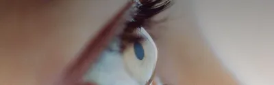Ожог глаза: причины, виды, симптомы, диагностика и лечение ожога глаза в  Москве - сеть клиник «Ниармедик»