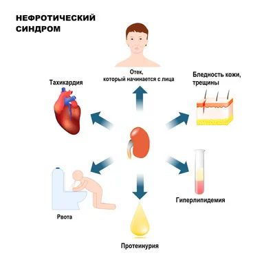 Мешки под глазами: причины появления, как избавиться?