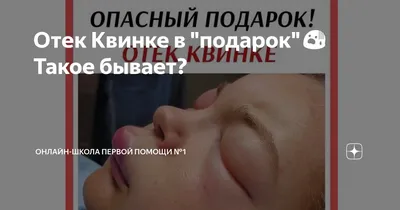 Папулы росли и чесались, это был кошмар»: жительница Новосибирска  заработала отек Квинке после мезотерапии - KP.RU