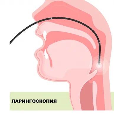 Настоящая Аллергическая Реакция У Мужчины Лицо Глаза Нос Ангиоедема —  стоковые фотографии и другие картинки Отёк Квинке - iStock