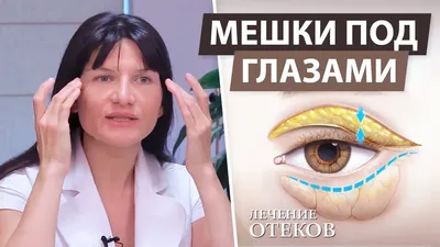 Проблема с левым глазом: причины, симптомы и методы лечения