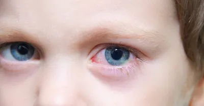 Диагностика ретинобластомы: увидеть, чтобы видеть