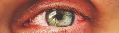 Самые частые травмы глаз: какие требуют экстренного лечения? - Всё о зрении.