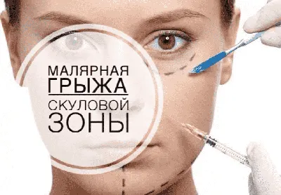 Как снять отеки под глазами | Face-room Kazan | Дзен